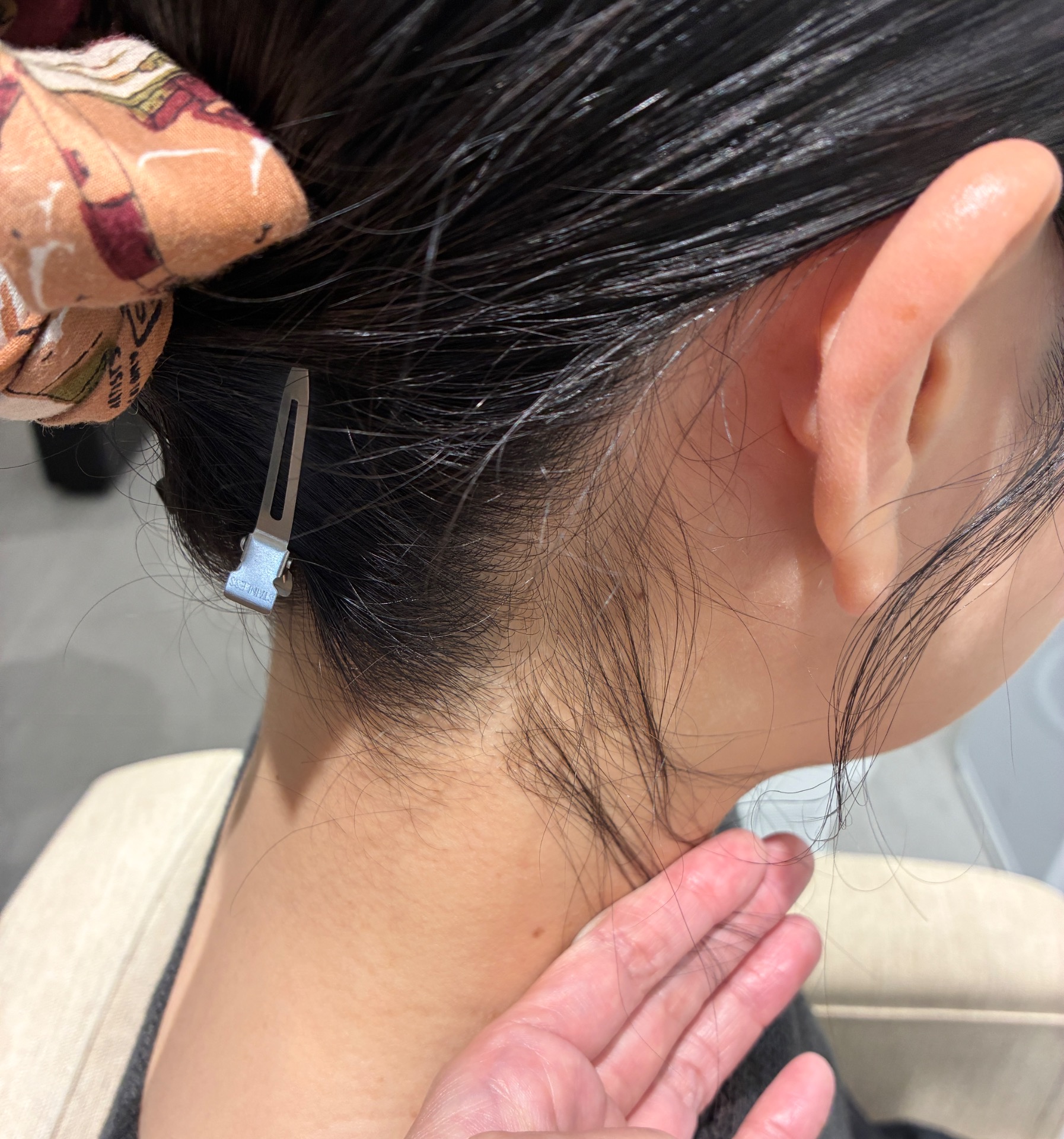 カウンセリングでお写真見ながらこの角を取ることにしました。